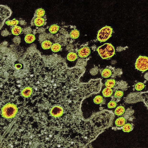 Đại dịch COVID-19 trong những tấm ảnh: Virus corona đã thay đổi thế giới của chúng ta như thế nào? - Ảnh 2.