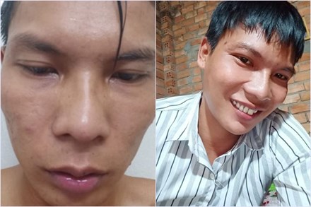 Được tặng tiền để làm thẩm mỹ, Lộc Fuho quyết tâm từ chối, bảo tồn nhan sắc