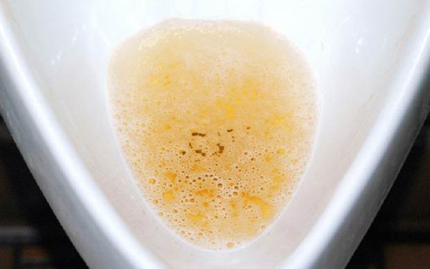 Những dấu hiệu không thể chối cãi cho thấy nam giới suy giảm khả năng QHTD - Ảnh 2.