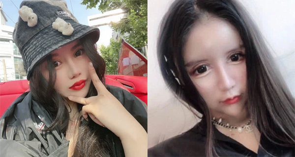 Phẫu thuật thẩm mỹ 100 lần trong 3 năm, cô gái bị bạn bè xa lánh vì &quot;chẳng thể cười một cách tự nhiên&quot;