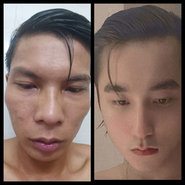 Được tặng tiền để làm thẩm mỹ, Lộc Fuho quyết tâm từ chối, bảo tồn nhan sắc  - Ảnh 1.
