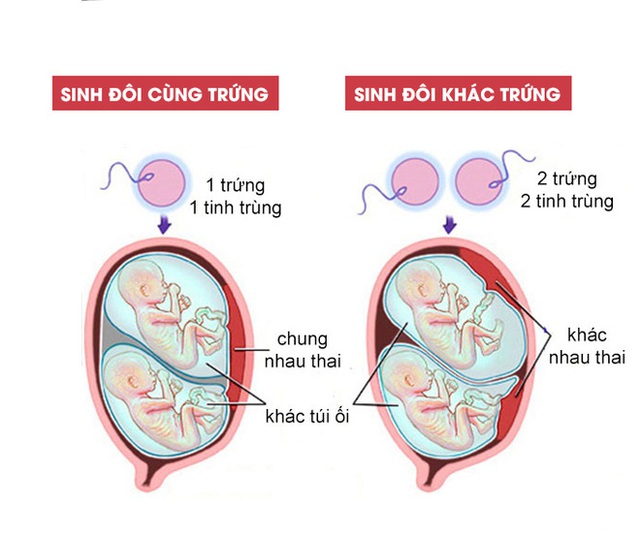 Những đứa trẻ sinh đôi: Bí ẩn tiến hóa hay chỉ là một tai nạn tình cờ? - Ảnh 2.