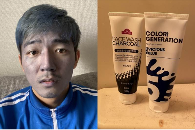 Dùng nhầm thuốc nhuộm tóc thay sữa rửa mặt, nam thanh niên đau xót khi bị cộng đồng mạng gọi là Thanos đời thực - Ảnh 2.