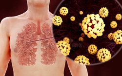 [Infographic] Đây là cách virus Covid-19 tàn phá cơ thể người